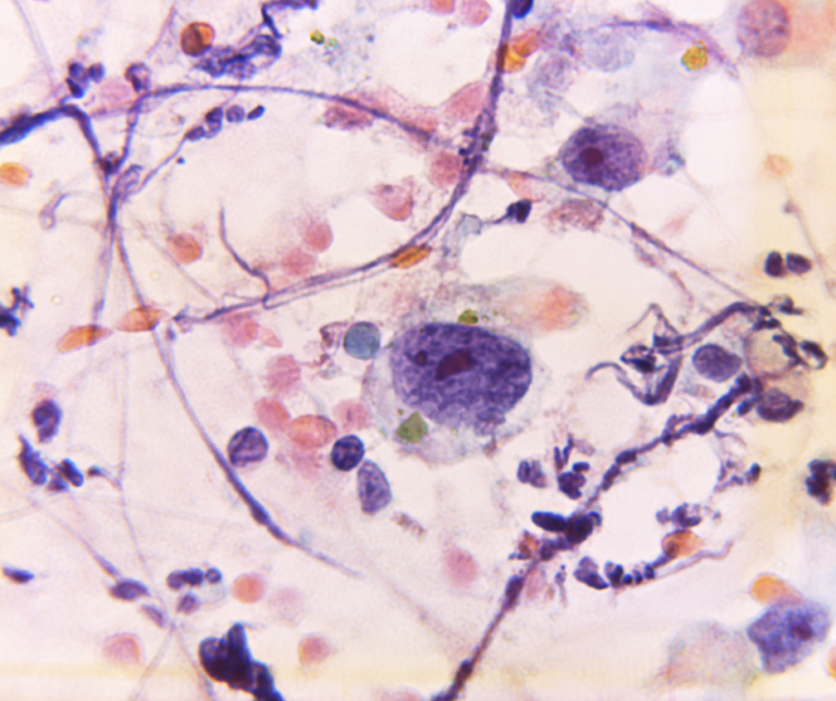 PL BioScience ELAREM™ Technology for Human Platelet Lysate