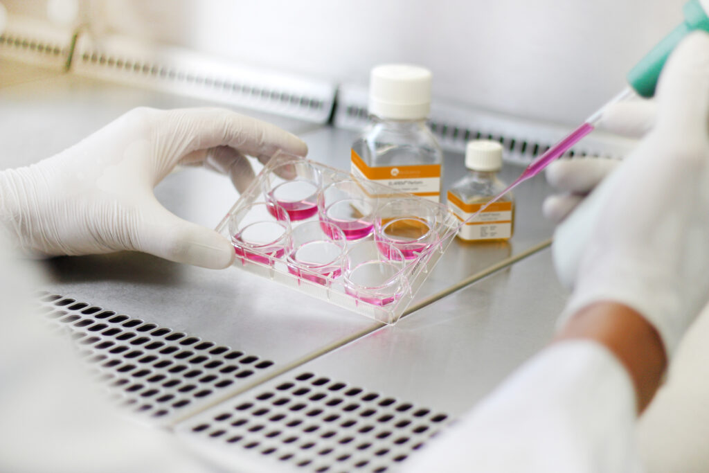 Human Platelet Lysate Sample